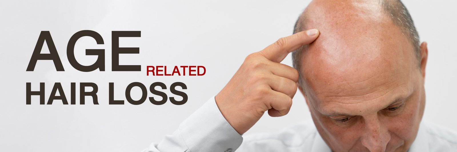 Age and Hairloss